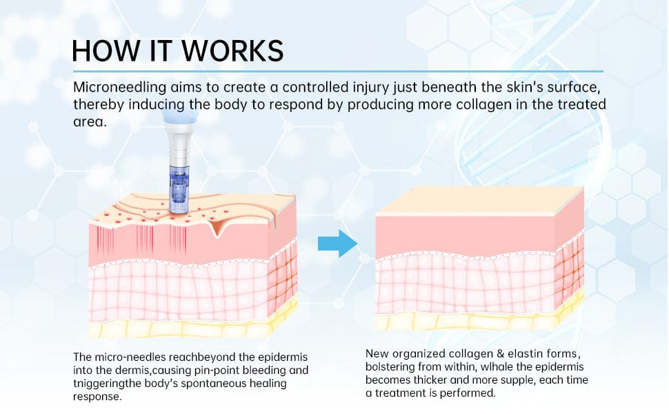 Sichuan Palace Dr.Pen A6 Professional Microneedling Pen